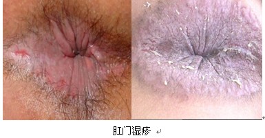在线咨询