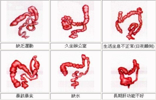 便秘危害