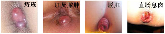咨询