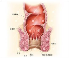 肛门疼痛是什么病
